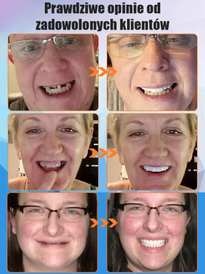 ✨ Silikon medyczny z UK, jakość dla klinik stomatologicznych✨