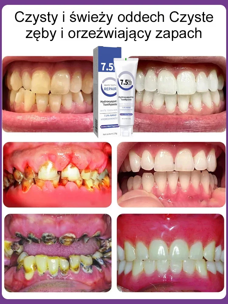 ✨Usuń nieprzyjemny oddech i chroń dziąsła, wybiel zęby i złagódź wrażliwość zębów