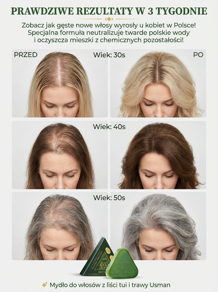 🌿Budzi martwe cebulki, w 7 dni hamuje łysienie, w 30 dni daje gęste nowe włosy!