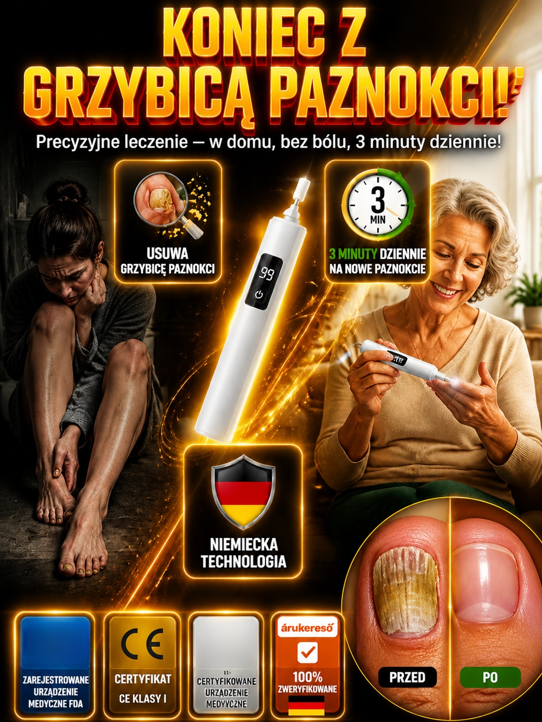 ✨Niemiecka, profesjonalna frezarka do paznokci! W zaledwie 3 minuty skutecznie usuwa twarde paznokcie, skórki i objawy grzybicy!