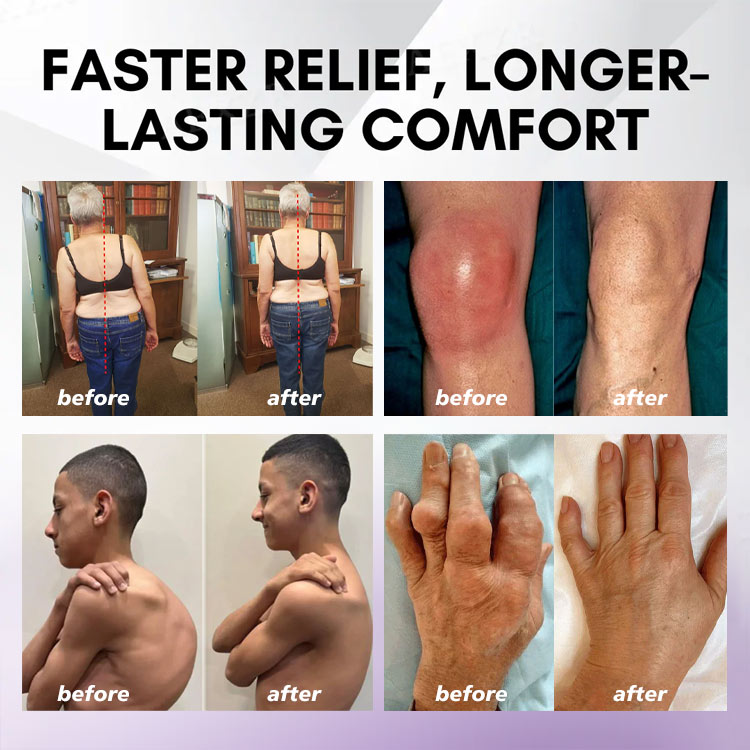 ⏰2026 New Year Special Offer🔥: Gsunleo™ Turmeric Emu Oil Arthritis Relief and Pain Relief Massage Gel👨‍⚕️ Certified by the American Osteopathic Association (AOA)