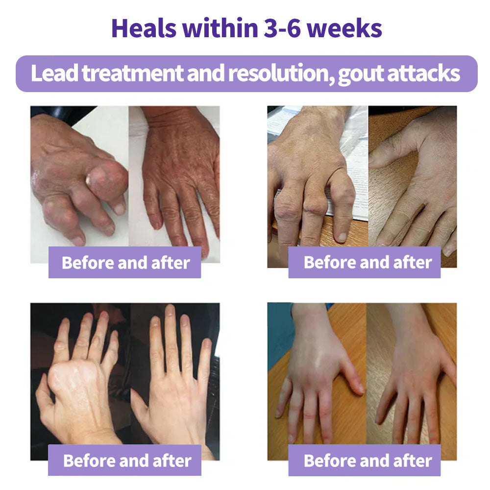 ⏰2026 New Year Special Offer🔥: Gsunleo™ Turmeric Emu Oil Arthritis Relief and Pain Relief Massage Gel👨‍⚕️ Certified by the American Osteopathic Association (AOA)