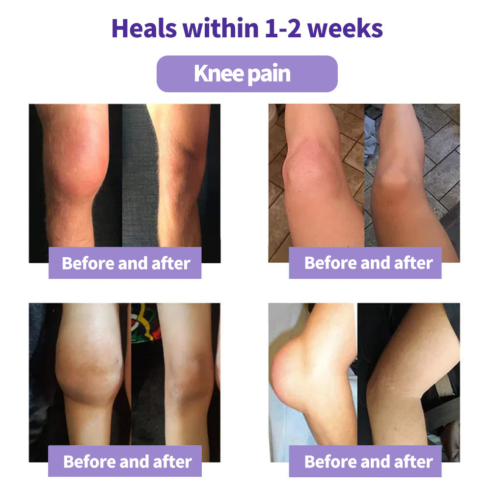 ⏰2026 New Year Special Offer🔥: Gsunleo™ Turmeric Emu Oil Arthritis Relief and Pain Relief Massage Gel👨‍⚕️ Certified by the American Osteopathic Association (AOA)