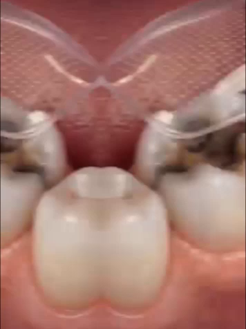 SEKRET DENTYSTÓW, KTÓREGO NIE CHCĄ, ABYŚ POZNAŁ! 🦷🤫 Odbuduj zęby za 1/10 ceny wizyty! 📉✨