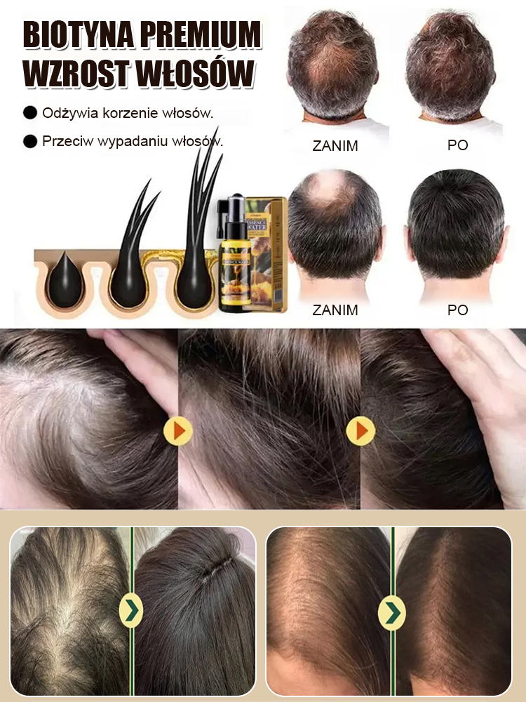 ✨Esencja przyspieszająca wzrost włosów, stymulująca mieszki włosowe, już po 15 dniach nowe włosy!