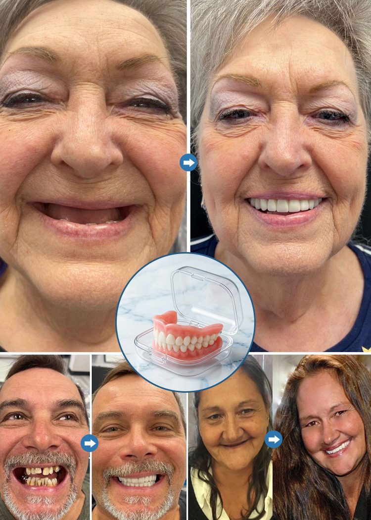 【Z przenośnym etui】Wysokiej jakości protezy zębowe! Idealne dopasowanie – możliwe do stosowania nawet przy całkowitym braku uzębienia! Odpowiednie dla każdego!【Tylko przez ograniczony czas: Kup 1, a 1 dostaniesz gratis!】