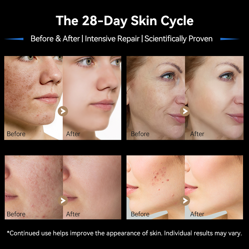 New Dr. Pen M9 Microneedling Pen