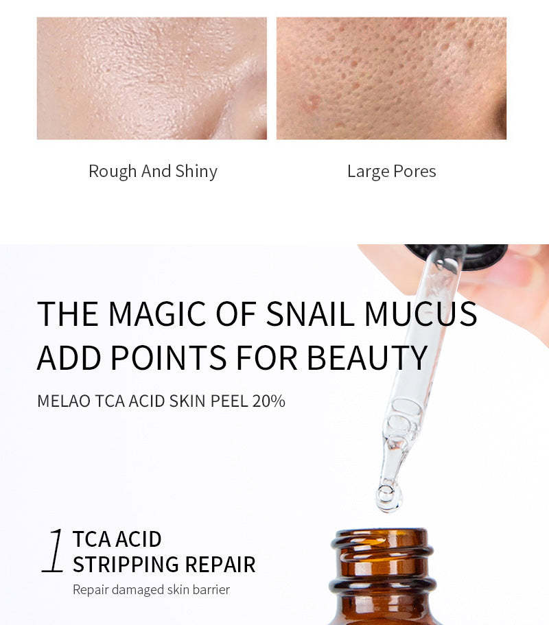 TCA ACID Skin Peel Serum 20%