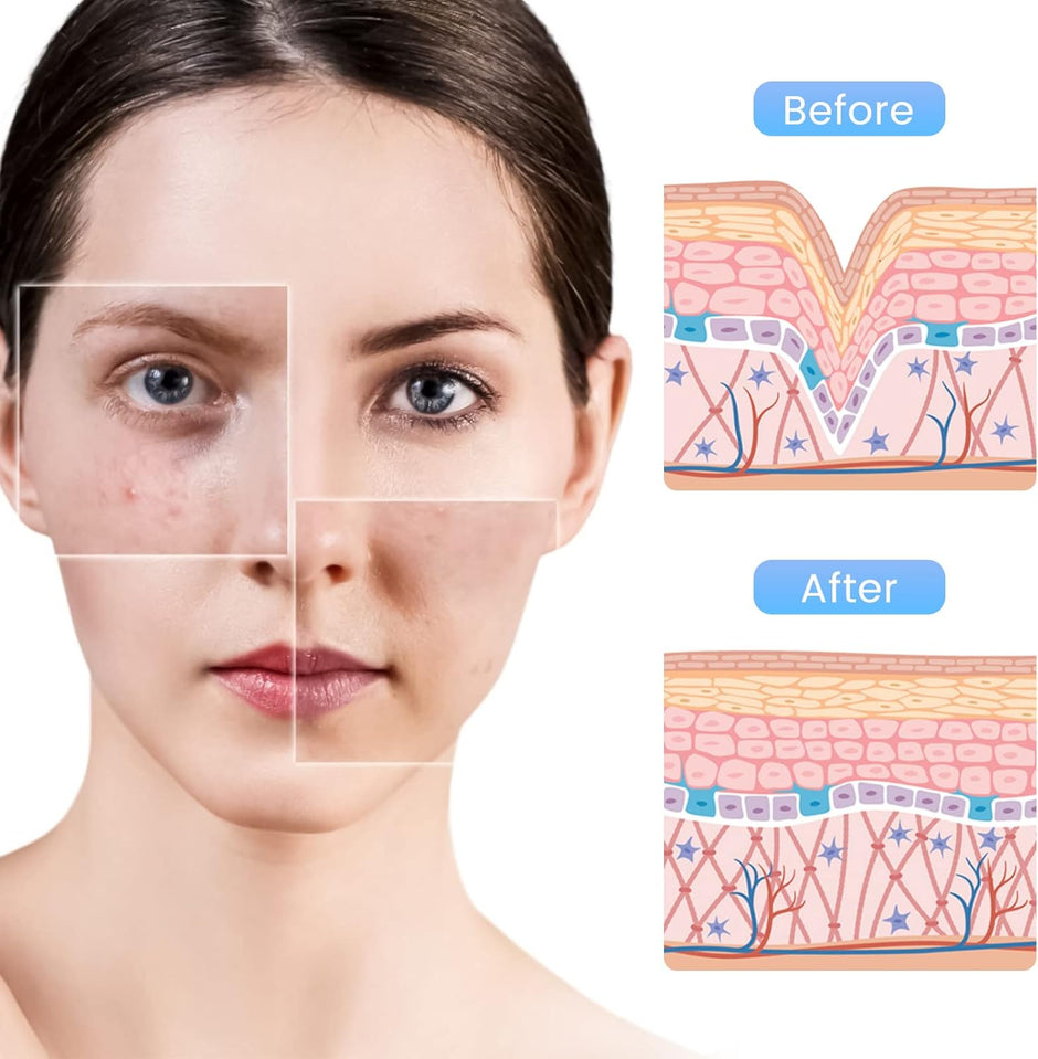 Microneedling Needles Replacement Needle Cartridges for Dr.Pen A10