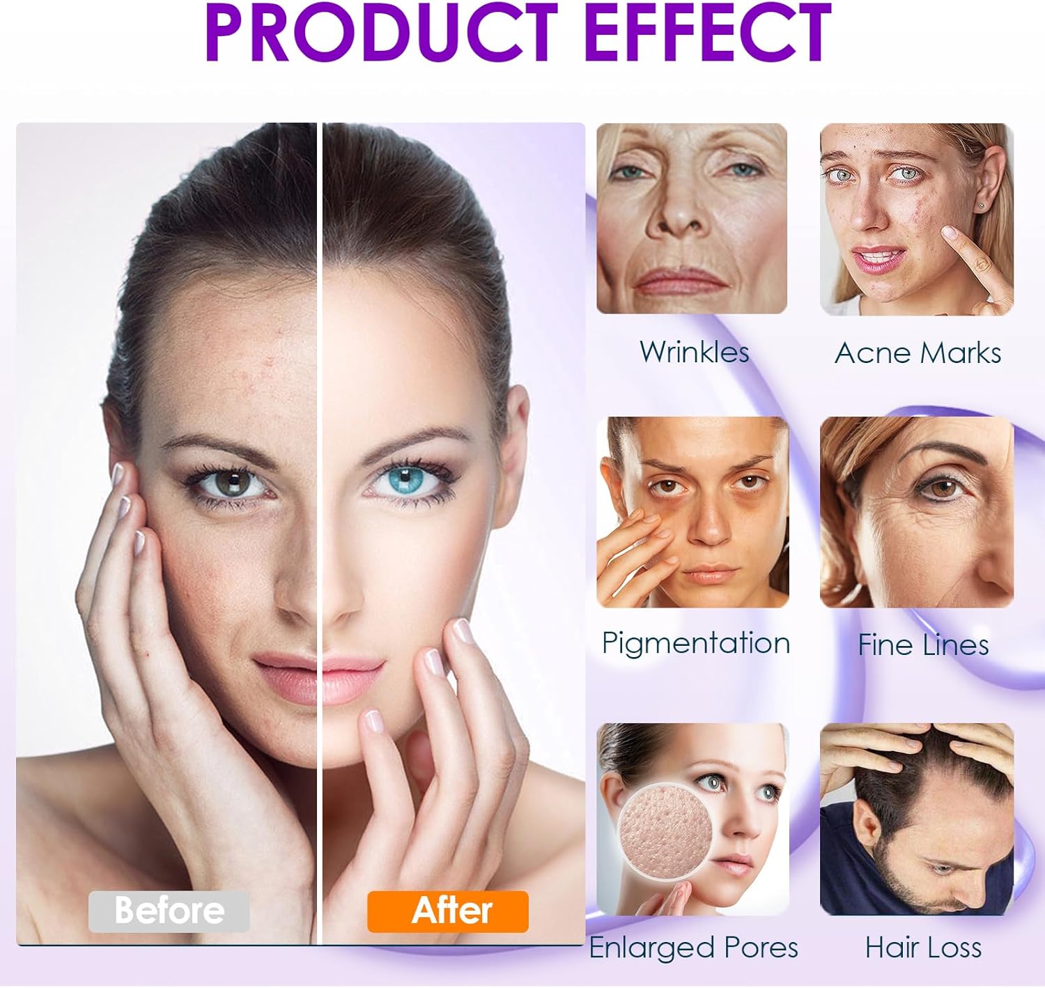 Microneedling Needles Replacement Needle Cartridges for Dr.Pen A10