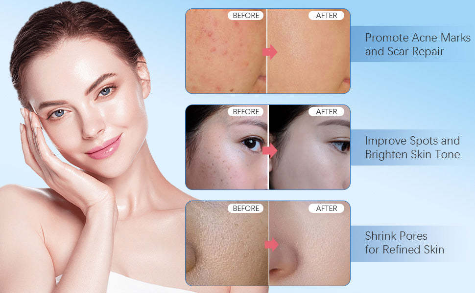 Dr Pen M8S Auto Microneedling Pen - Including 12 Pcs Replacement Cartridges