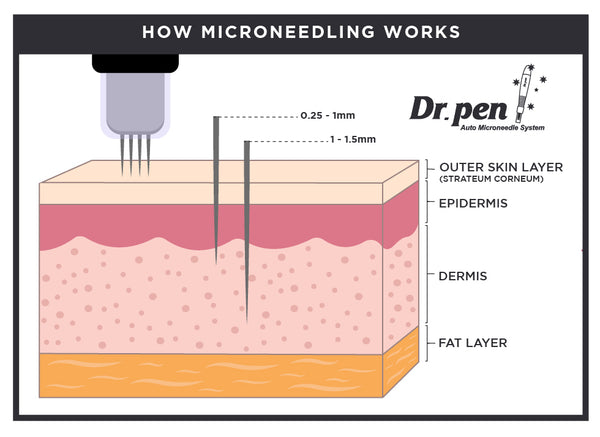 wound healing response by microneedling pen illustration