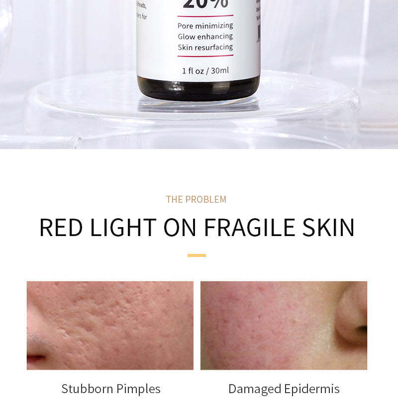 TCA ACID Skin Peel Serum 20%