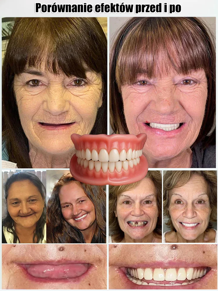 【Uśmiech w 3 minuty】Termoaktywne Nakładki na Zęby✨Bez Dentysty i Kleju✅Kup 2+1 Gratis & 90 DniGwarancji