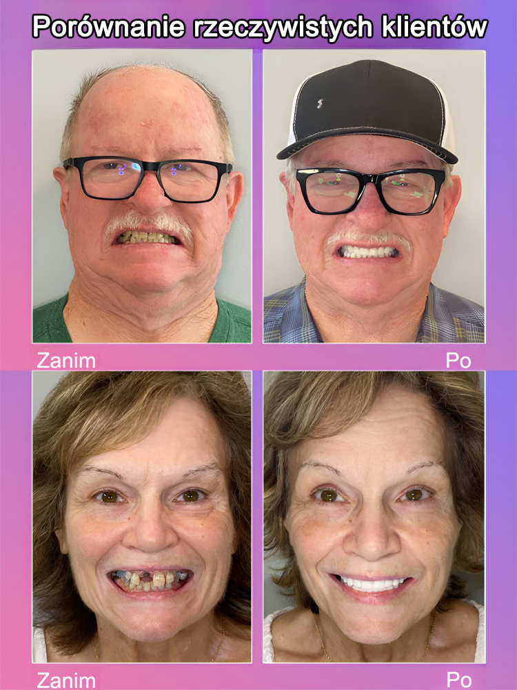 【Można założyć w sekundę】Luksusowe, personalizowane protezy dentystyczne✨Idealnie dopasowane do każdego zęba, pozwalają cieszyć się wszelkiego rodzaju przysmakami do woli.