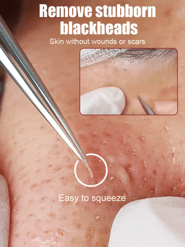 German Precision Beauty Salon Cell Clamp