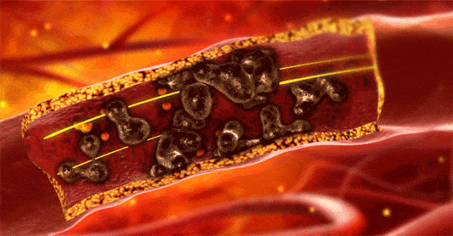 血液循环 (4).gif