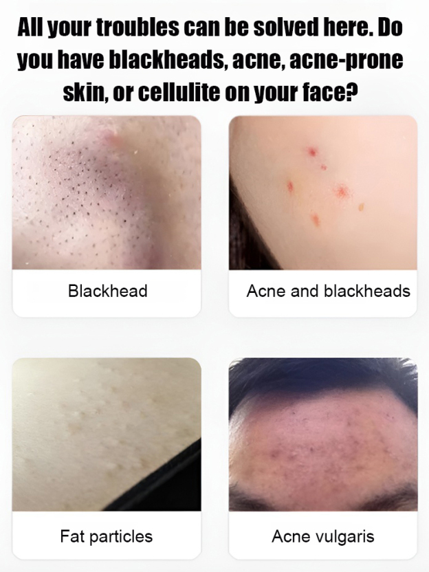 German Precision Beauty Salon Cell Clamp