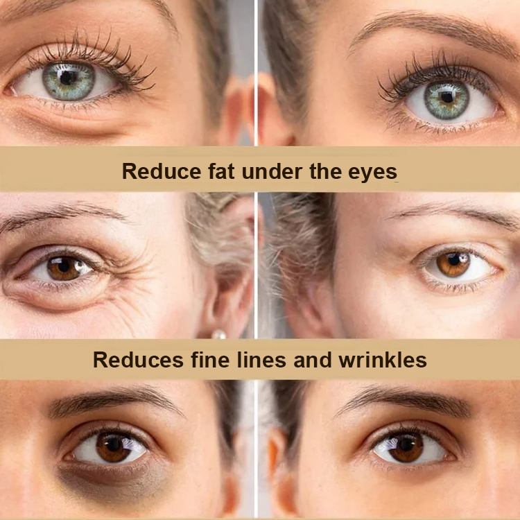 【Back to 20】Anti-wrinkle and firming eye essence oil