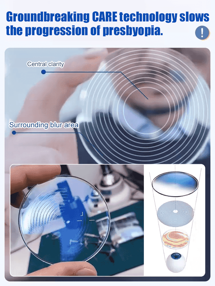 👨‍⚕️🥇 No Eye Exam Needed! Autofocus Glasses for 100° to 700° – One Pair Fixes Presbyopia, Myopia & Astigmatism ⚡ Ultra-light 7g frame – zero pressure on nose or ears 👓 All-day comfort. Instant clarity. No switching glasses.