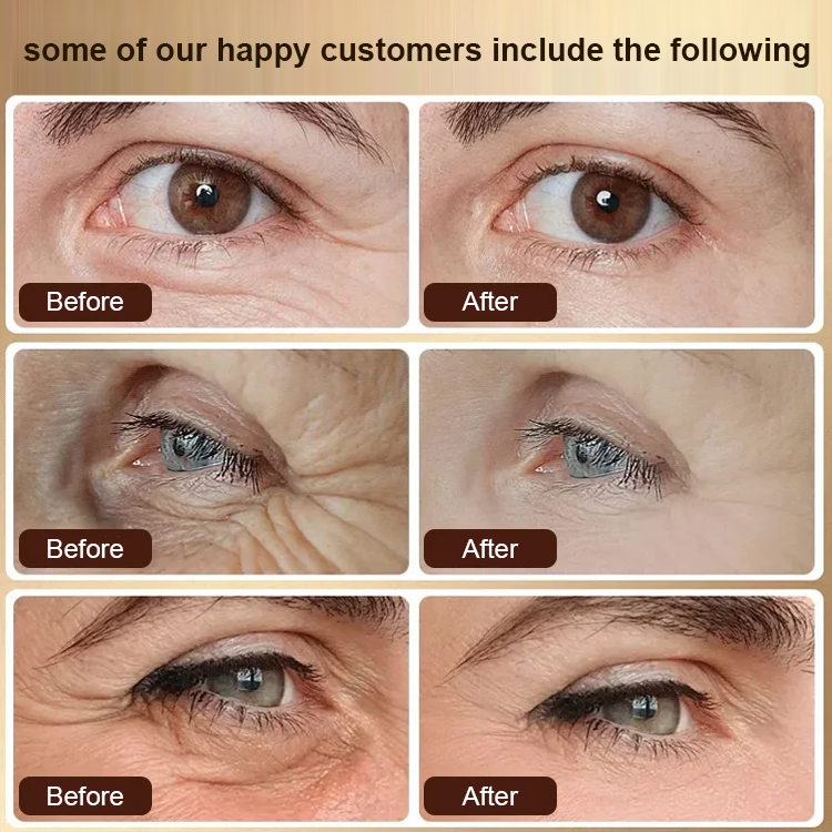 【Back to 20】Anti-wrinkle and firming eye essence oil