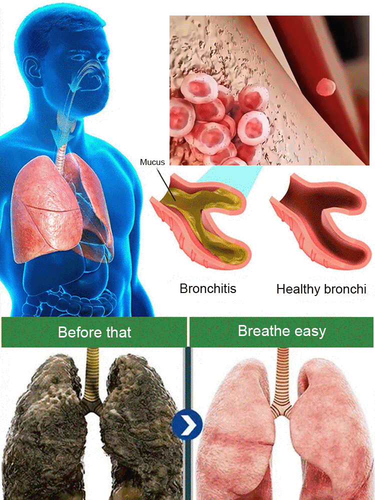 【Breathe Freely】Lung Cleanser Supplement