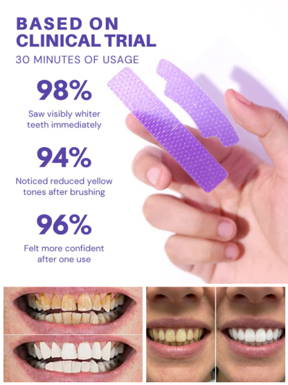 💜 Purple Magic Teeth Whitening Strips 🦷Cancel Yellow in 10 Minutes – No Pain, No Peroxide! ✨