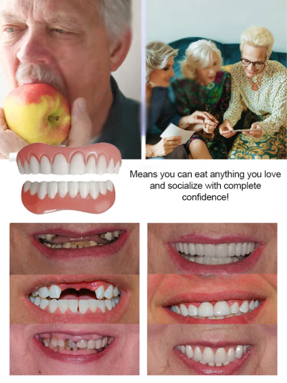 [Free Braces] Dental Fixative Adhesive for Comfortable Teeth Retention 