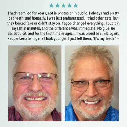 3-in-1 Teeth Whitening & Denture Cosmetic Kit