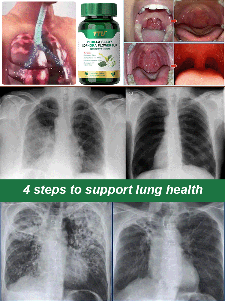 【Breathe Freely】Lung Cleanser Supplement