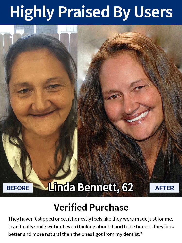 Adjustable Snap-On Dentures