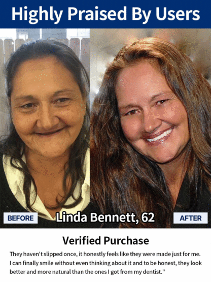 Adjustable Snap-On Dentures