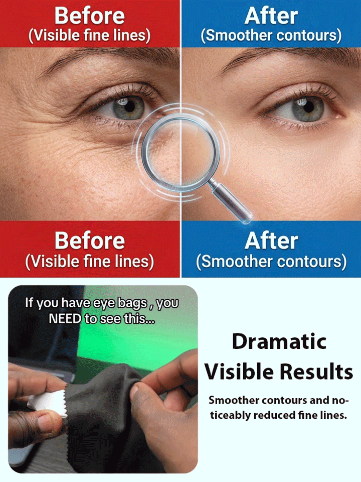 EMS Eye Microcurrent Beauty Device (Visible Results in 3 Days)