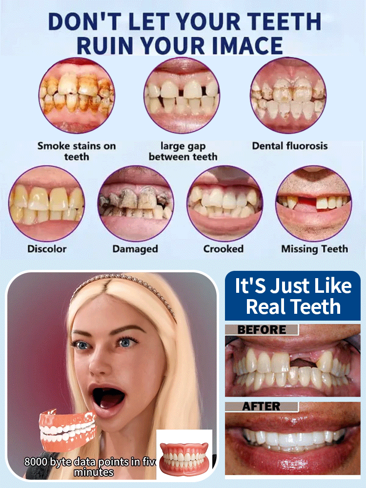 Adjustable Snap-On Dentures