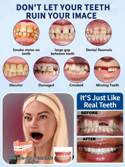 Adjustable Snap-On Dentures