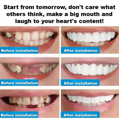 No glue required, installs in 1 second. Perfect Smile Dentures