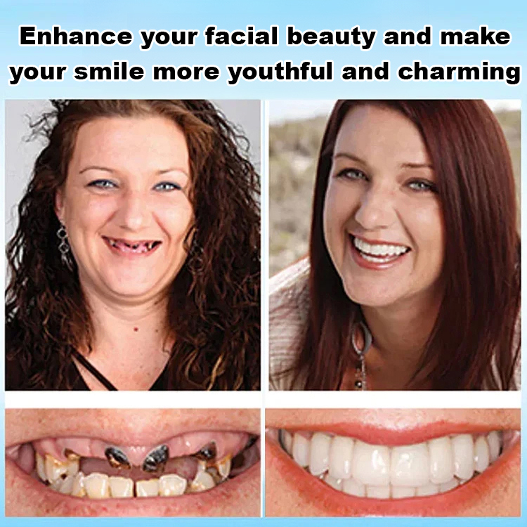 No glue required, installs in 1 second. Perfect Smile Dentures