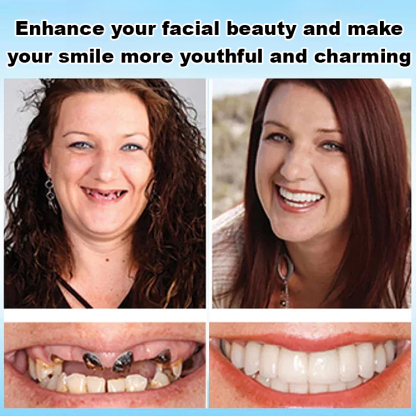 No glue required, installs in 1 second. Perfect Smile Dentures