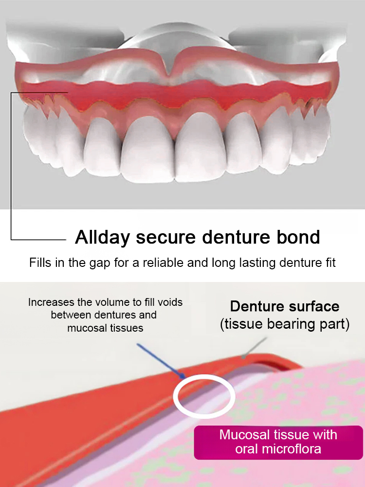 [Free Braces] Dental Fixative Adhesive for Comfortable Teeth Retention 