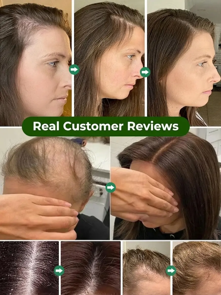 Stop Hair Thinning at the Source! 🌿 Our viral Rosemary & Ginger Shampoo uses nature’s powerful DHT blockers to reawaken dormant follicles. Get visibly thicker, stronger hair in just 2 weeks.