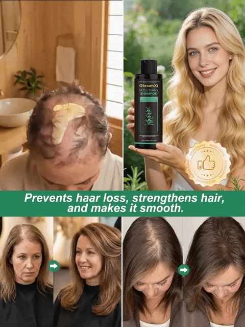 Stop Hair Thinning at the Source! 🌿 Our viral Rosemary & Ginger Shampoo uses nature’s powerful DHT blockers to reawaken dormant follicles. Get visibly thicker, stronger hair in just 2 weeks.