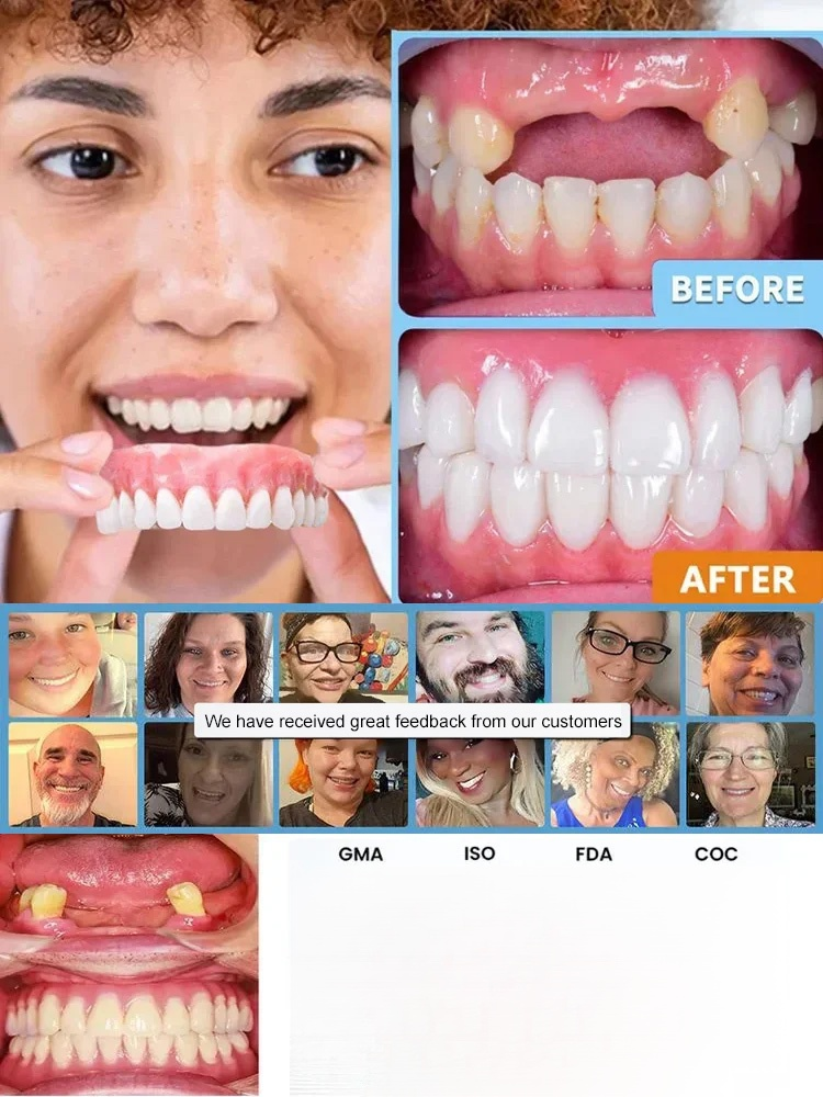 [No Dentist Required] Confident Smile: Full Denture Solution✅99.6% Positive Ratings – Proven Effective by Hundreds of Thousands of Consumers
