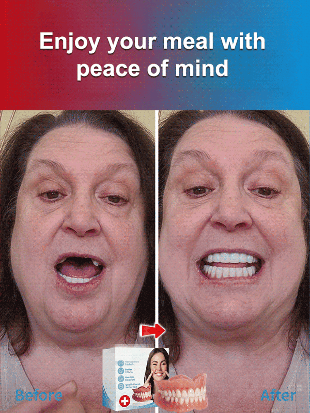 [No Dentist Required] Confident Smile: Full Denture Solution✅99.6% Positive Ratings – Proven Effective by Hundreds of Thousands of Consumers