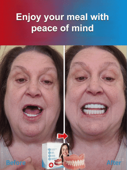 [No Dentist Required] Confident Smile: Full Denture Solution✅99.6% Positive Ratings – Proven Effective by Hundreds of Thousands of Consumers