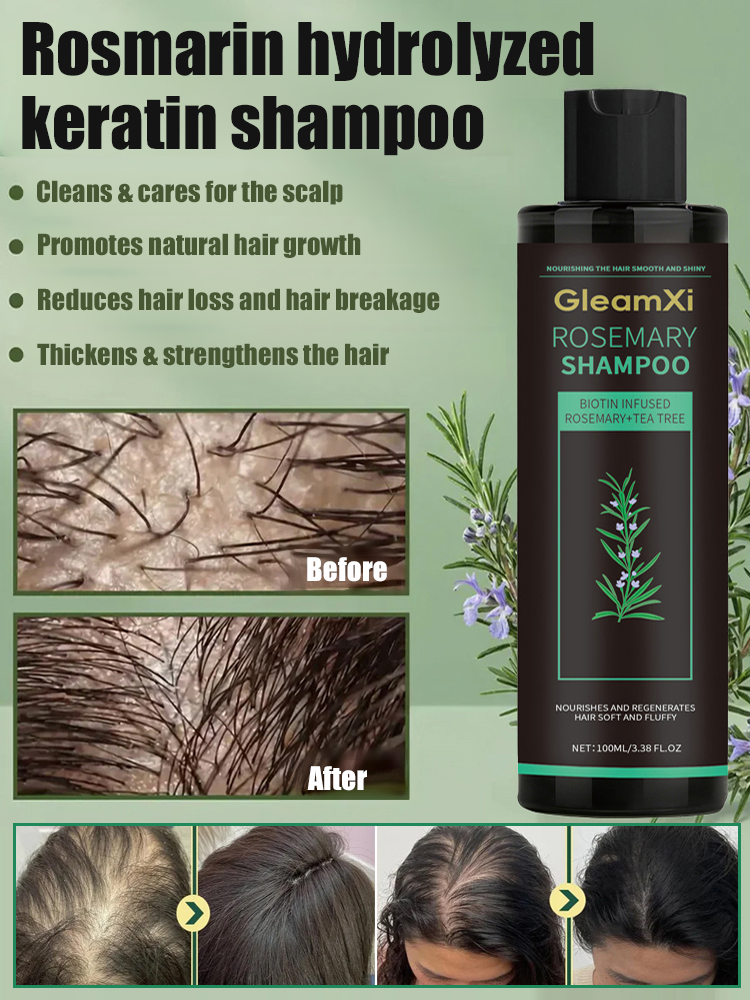 Stop Hair Thinning at the Source! 🌿 Our viral Rosemary & Ginger Shampoo uses nature’s powerful DHT blockers to reawaken dormant follicles. Get visibly thicker, stronger hair in just 2 weeks.