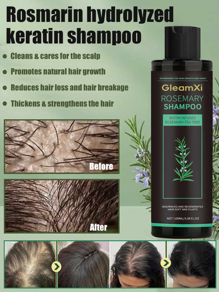 Stop Hair Thinning at the Source! 🌿 Our viral Rosemary & Ginger Shampoo uses nature’s powerful DHT blockers to reawaken dormant follicles. Get visibly thicker, stronger hair in just 2 weeks.