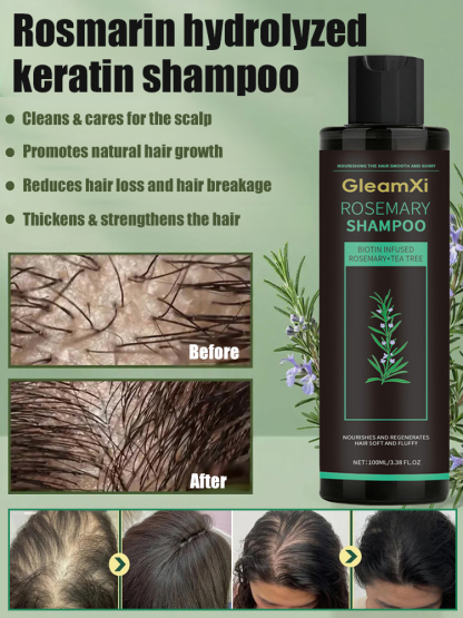 Stop Hair Thinning at the Source! 🌿 Our viral Rosemary & Ginger Shampoo uses nature’s powerful DHT blockers to reawaken dormant follicles. Get visibly thicker, stronger hair in just 2 weeks.