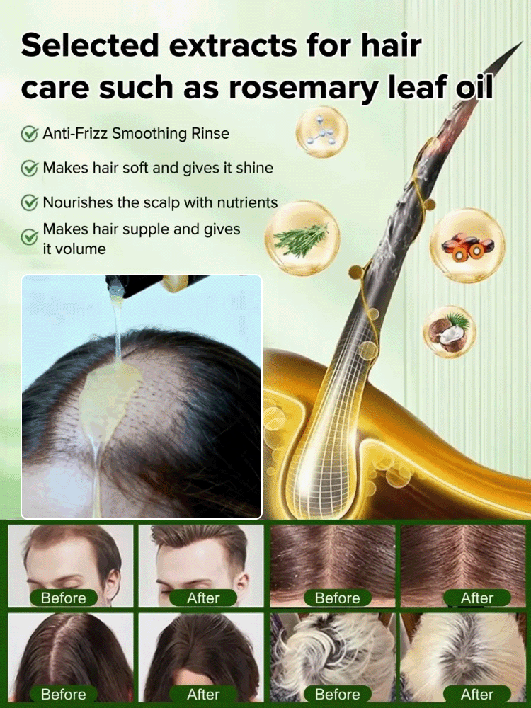 Stop Hair Thinning at the Source! 🌿 Our viral Rosemary & Ginger Shampoo uses nature’s powerful DHT blockers to reawaken dormant follicles. Get visibly thicker, stronger hair in just 2 weeks.