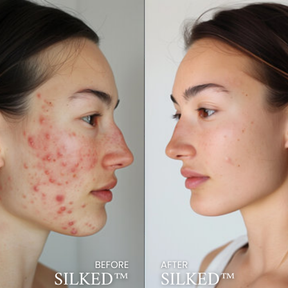 Silked Comfort Case🔥Buy One Get One Free✨