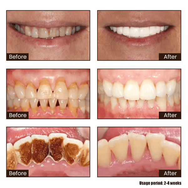 New 7-Pro Intensive Toothpaste | Upgraded Purple Formula with 7 Probiotics | Deep Enamel Repair & Long-Lasting Freshness